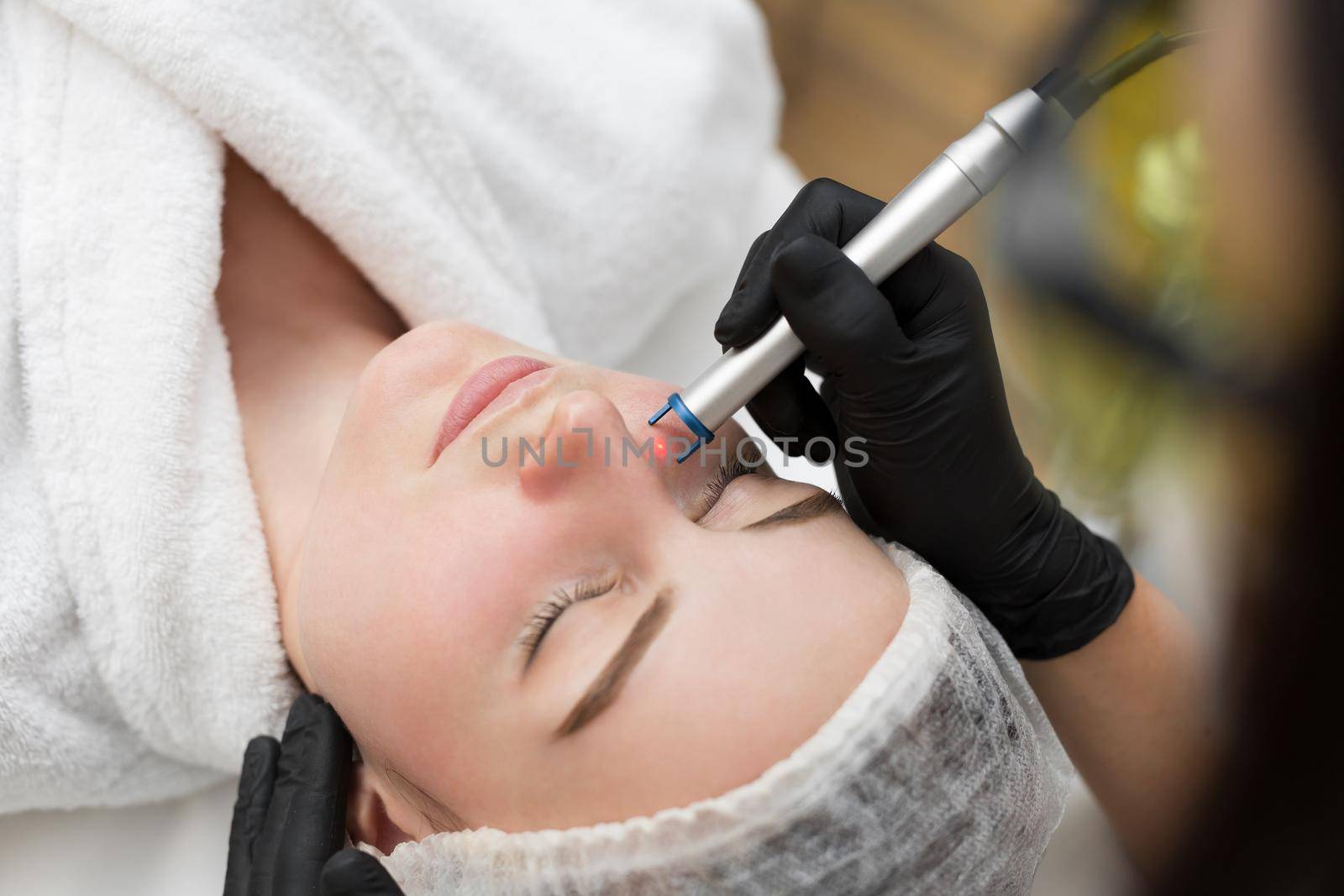 Close-up removal of blood vessels on the face of a diode laser in a cosmetic clinic. Therapist beautician makes a laser treatment to young woman's face at beauty SPA clinic