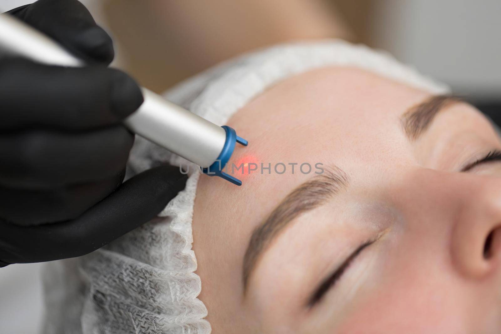 Close-up removal of blood vessels on the face of a diode laser in a cosmetic clinic. Therapist beautician makes a laser treatment to young woman's face at beauty SPA clinic. by StudioPeace