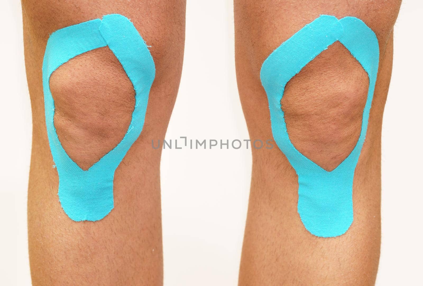 Cucasian Man knees with Lymphatic knee technique. Kinesiology Tape, white background.