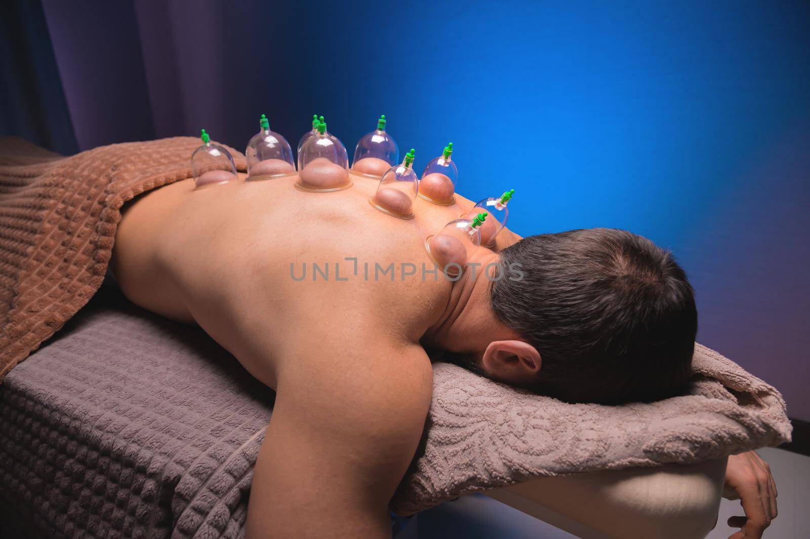 Cup massage in general. Vacuum jars for back massage for a man. Massage with vacuum cups. Cupping treatments for back pain relief. Caucasian man lies face down with mounted vacuum cups on his back.