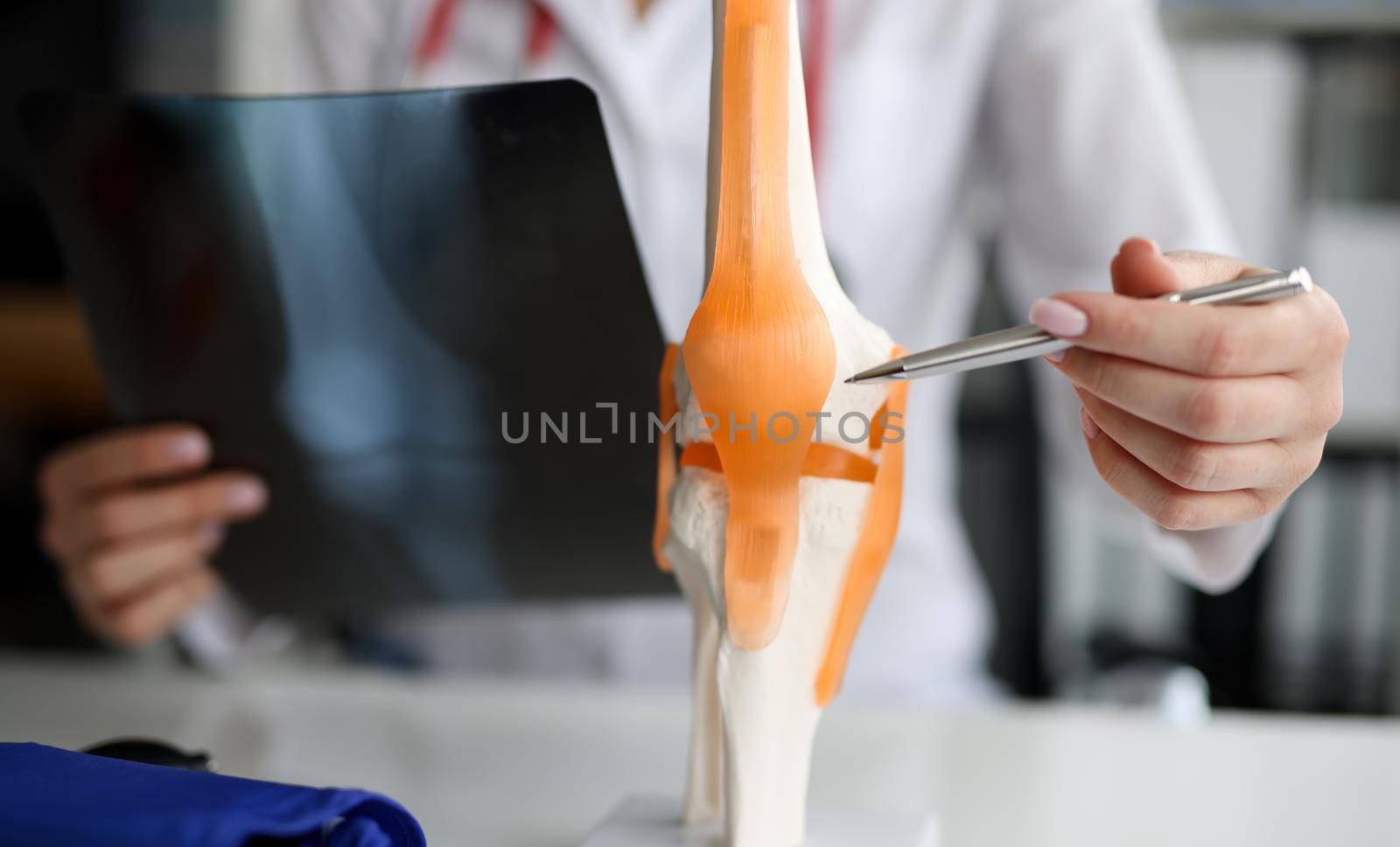 Doctor with xray in his hands showing structure of knee joint on artificial model closeup. Trauma medical education concept