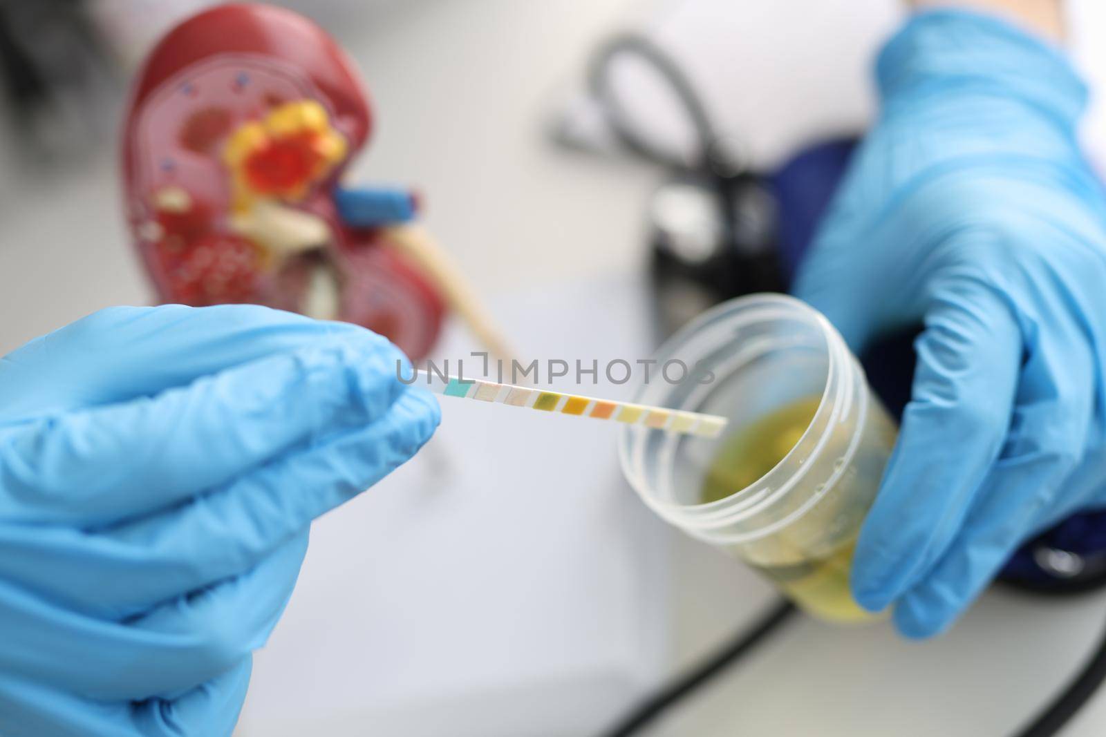 Doctor urologist making express urine test using indicator paper closeup. Diagnosis of kidney disease concept