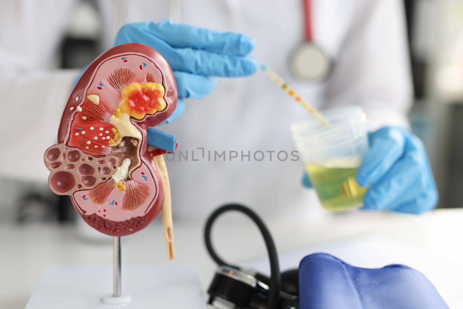 Artificial model of kidney and ureter of human standing on table of urologist doctor with urine test closeup. Diagnosis and treatment of diseases of urinary system concept