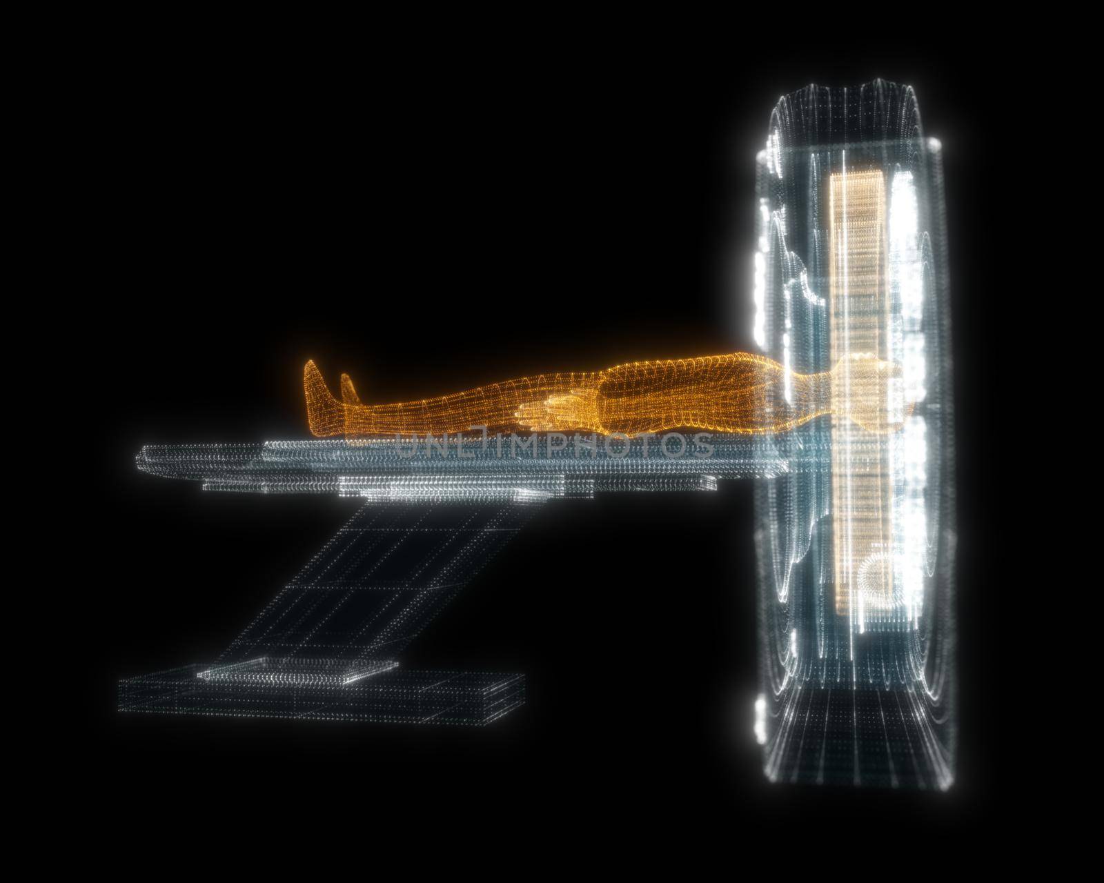 Digital MRI scan with patient Hologram. Medicine and Technology Concept. Interface element. 3d illustration