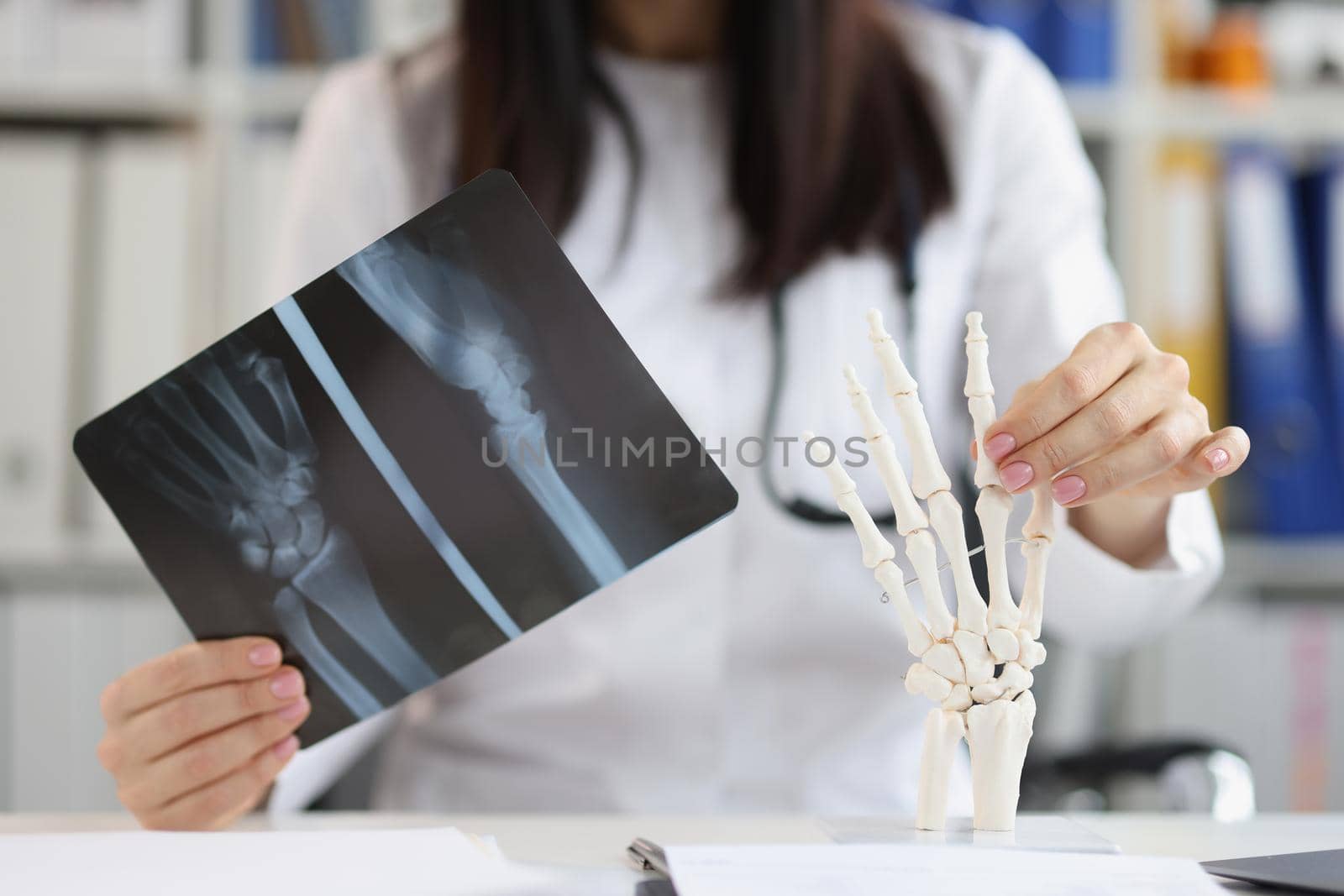 X-ray of the hand in the hands of a doctor, close-up, blurry. Skeleton wrist training medical students