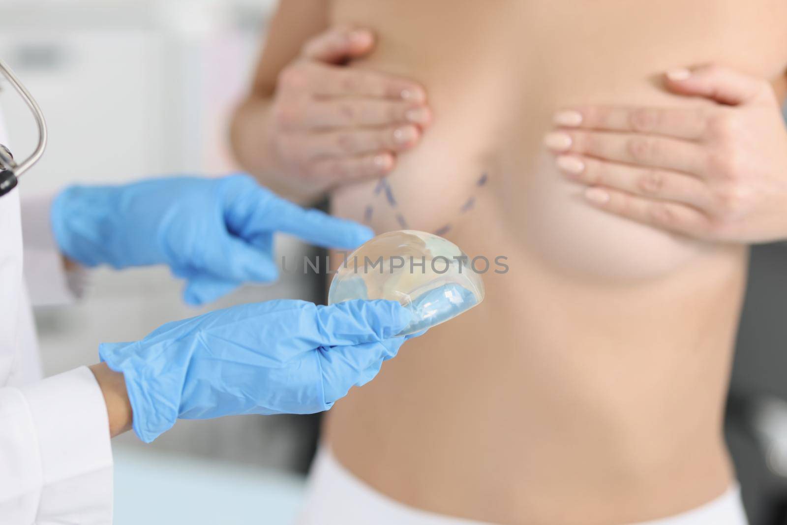 The doctor's hand holds silicone breast implant near patient by kuprevich