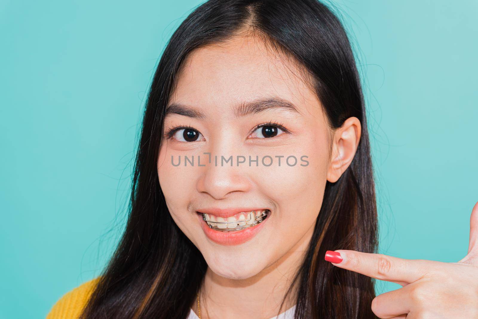 young woman teen pointing finger to teeth by Sorapop