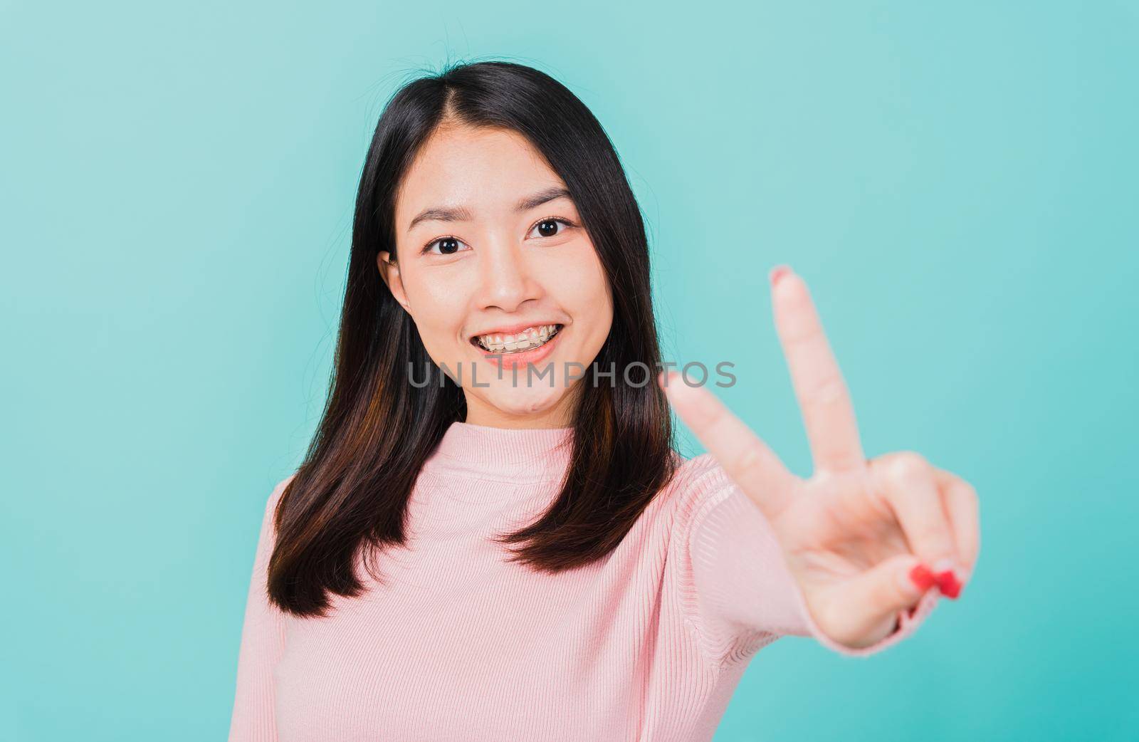 woman smiling wear silicone orthodontic retainers on teeth showing v-sign victory finger by Sorapop