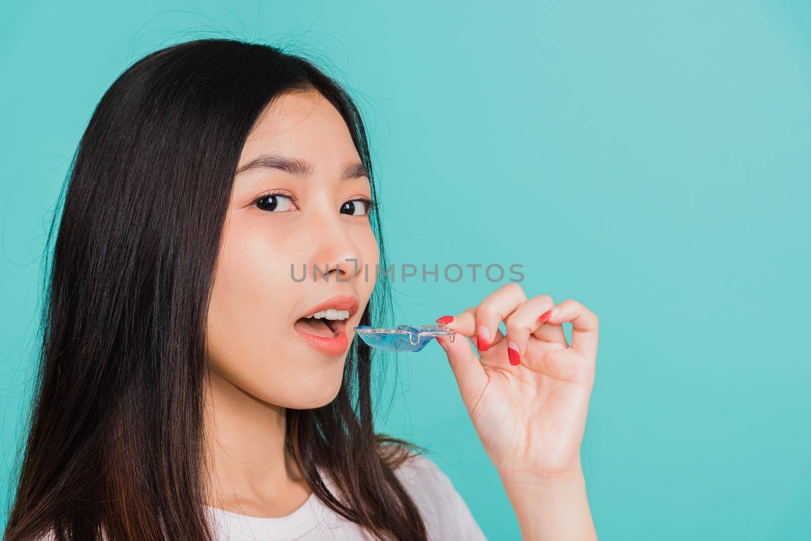 Female hold teeth retaining tools after removable braces, Portrait young Asian beautiful woman smiling wear putting silicone orthodontic retainers for teeth, Orthodontics dental healthy care concept