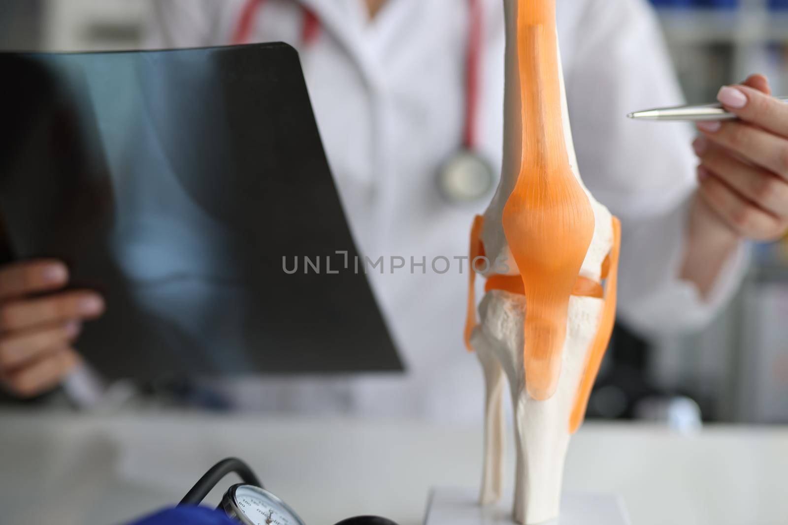 Doctor traumatologist demonstrating bones of knee joint on artificial model and taking xray picture closeup. X ray diagnosis of rheumatoid arthritis concept