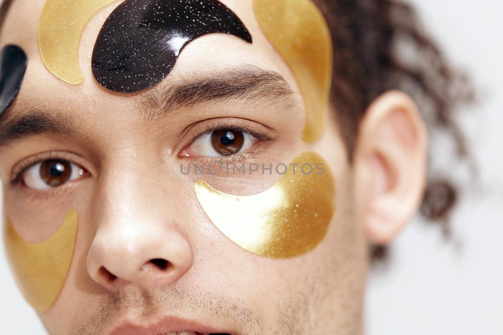 A young man many patches on the face touches face with hands close-up. High quality photo