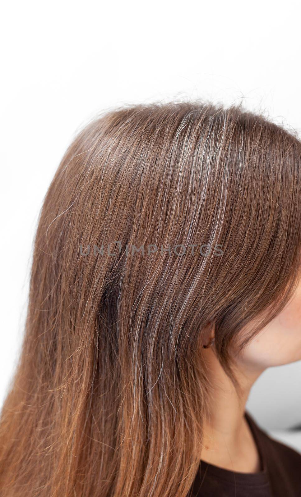 Brown hair on a woman's head close-up. Hair regrowth by AnatoliiFoto