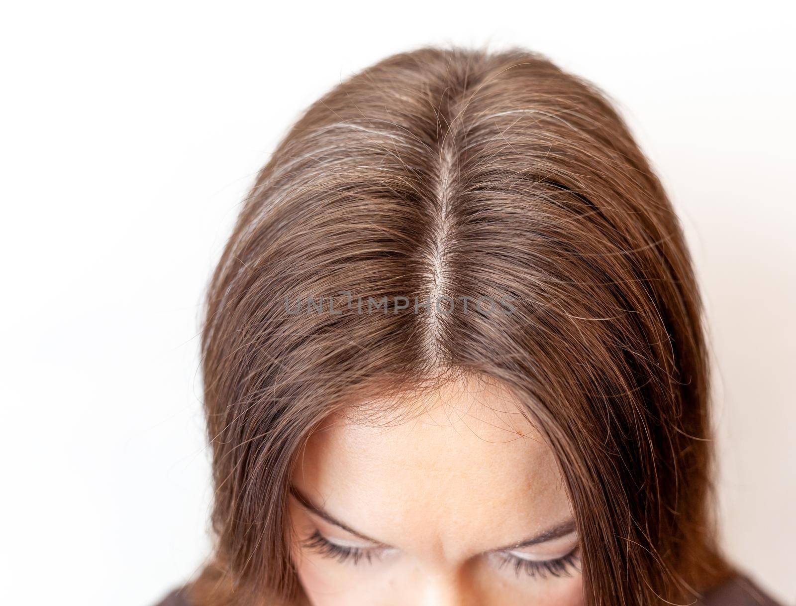 Brown hair on a woman's head close-up. Hair regrowth by AnatoliiFoto