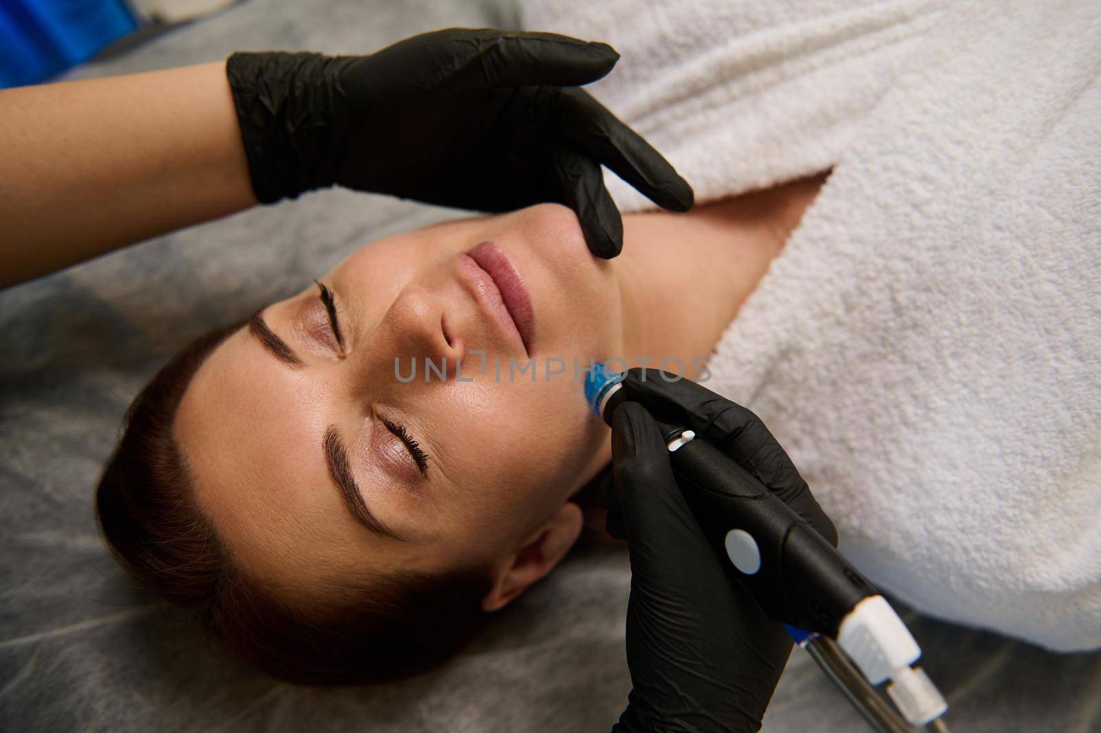 Face skin care. Close-up of woman getting facial hydro microdermabrasion peeling treatment at cosmetic beauty spa clinic. Hydra vacuum cleaner. Exfoliation, rejuvenation and hydratation. Cosmetology.