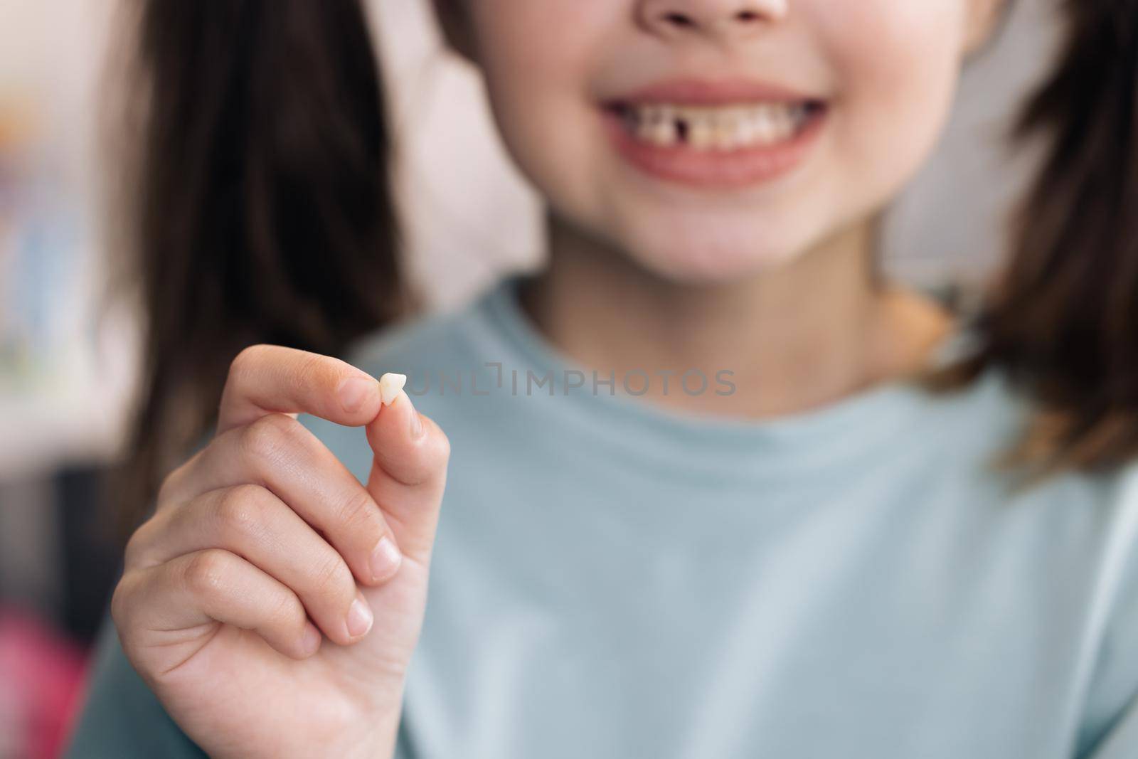 Little Girl Loosing her baby teeth. Little girl with milk temporary tooth. Happy child holding her fallen tooth in hand. Dental medicine or temporary teeth health care concept. by uflypro