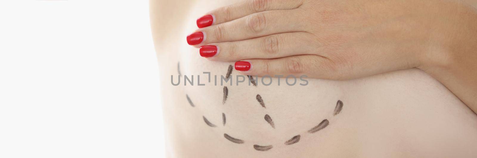 Close-up of woman closing breast with hand, marking on boob for future cosmetic surgery operation, prepare for procedure in clinic. Medicine, beauty, plastic, cosmetic surgery concept