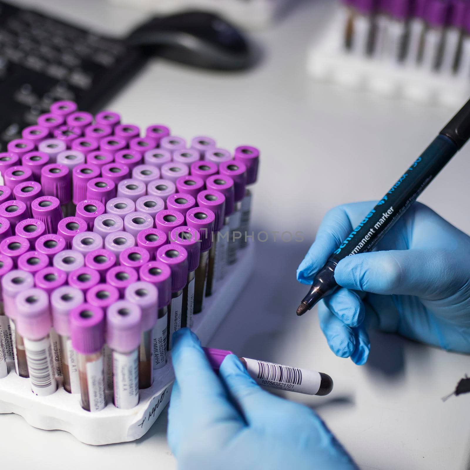 Test tubes in the laboratory in which PCR tests are done for the determination of coronavirus by elenarostunova