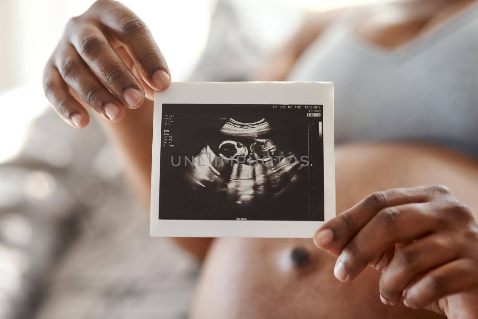 Closeup shot of an unrecognisable woman holding a sonogram at home.