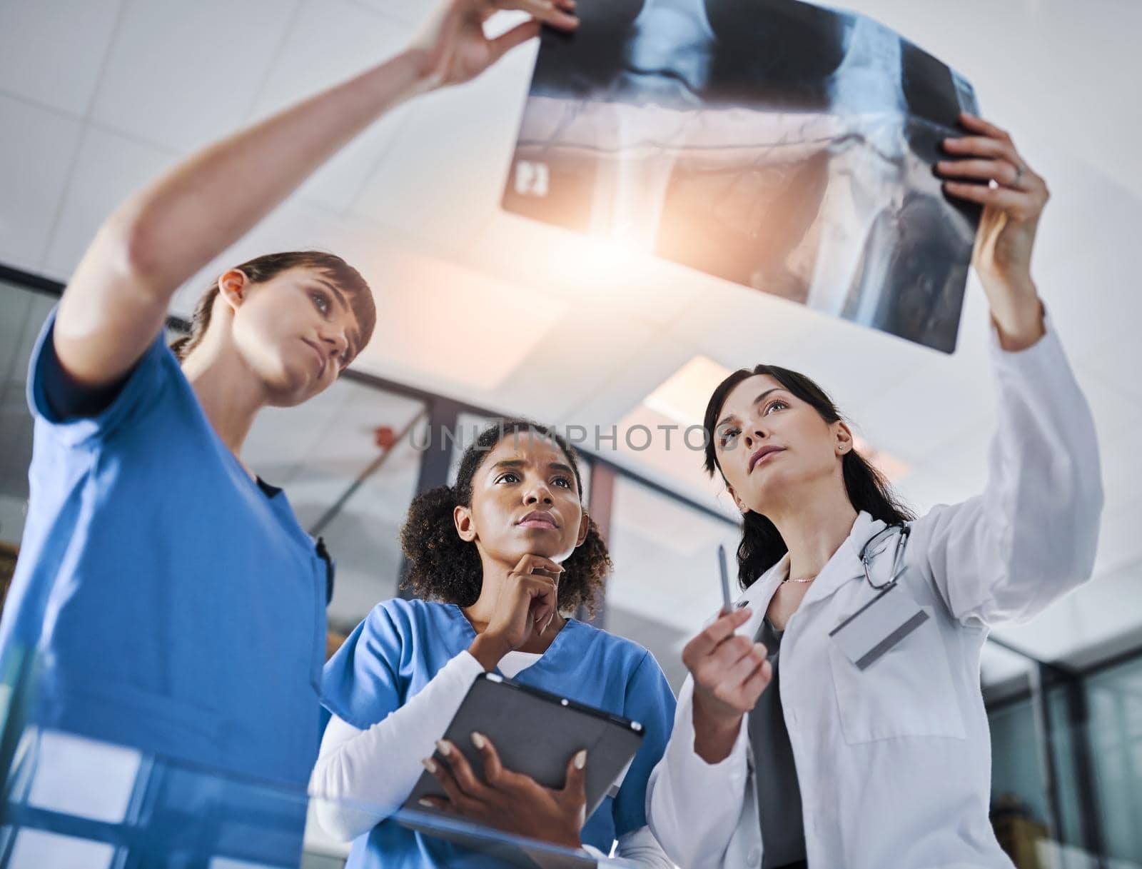 Shot of a group of doctors discussing the results of an X-ray in a hospital.