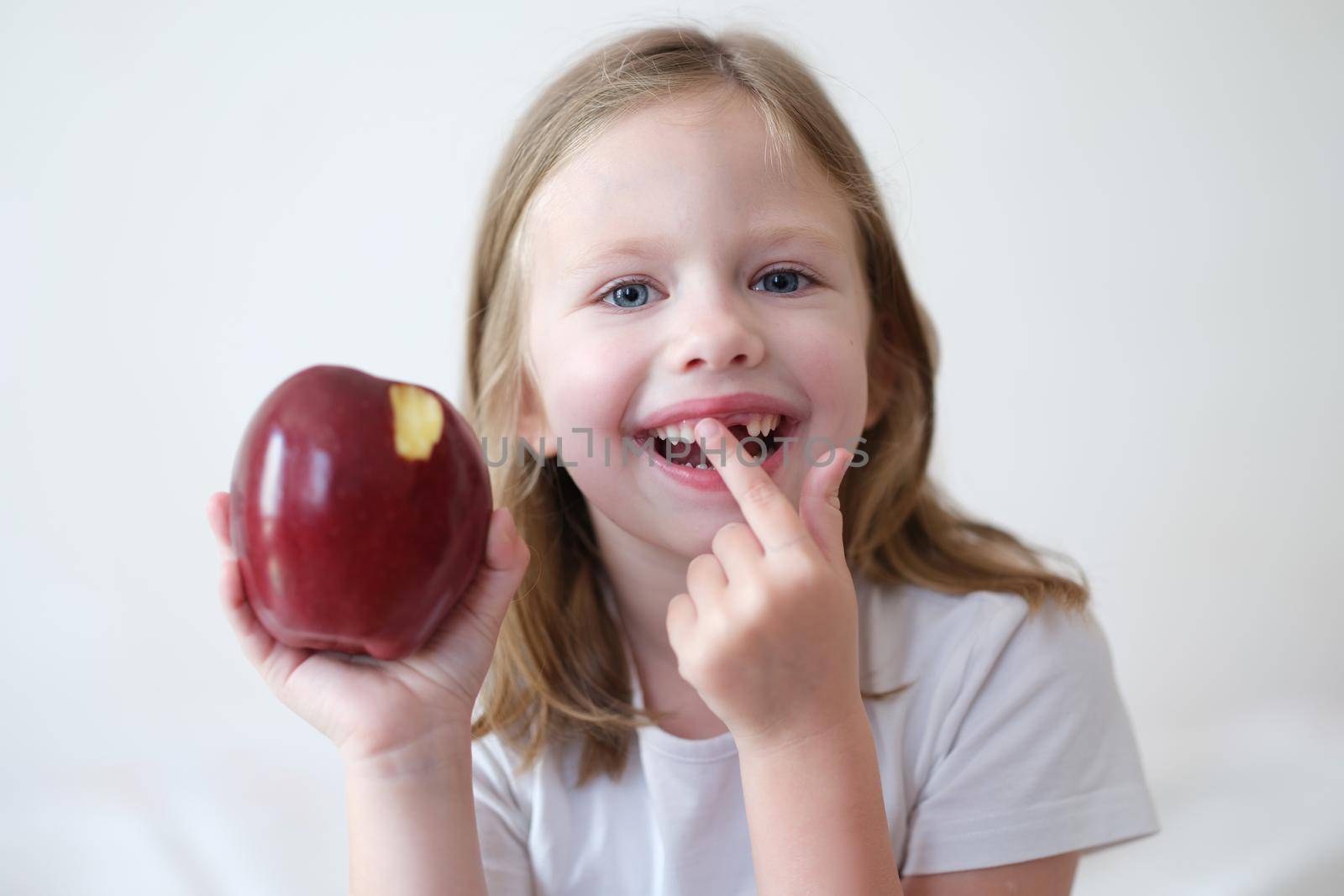 Smiling girl without tooth is holding apple. Pediatric dentistry and loss of milk teeth concept