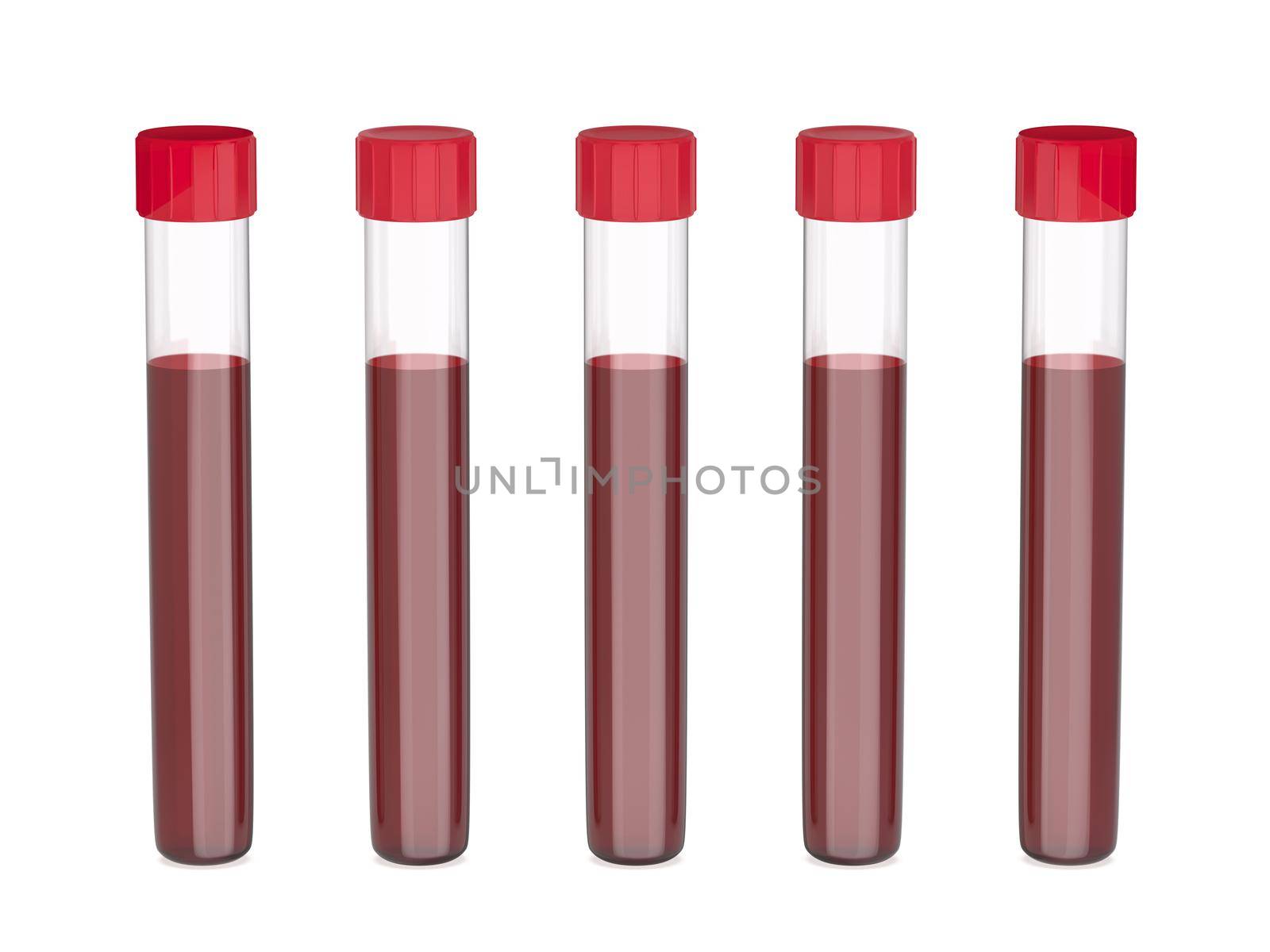 Test tubes with blood by magraphics