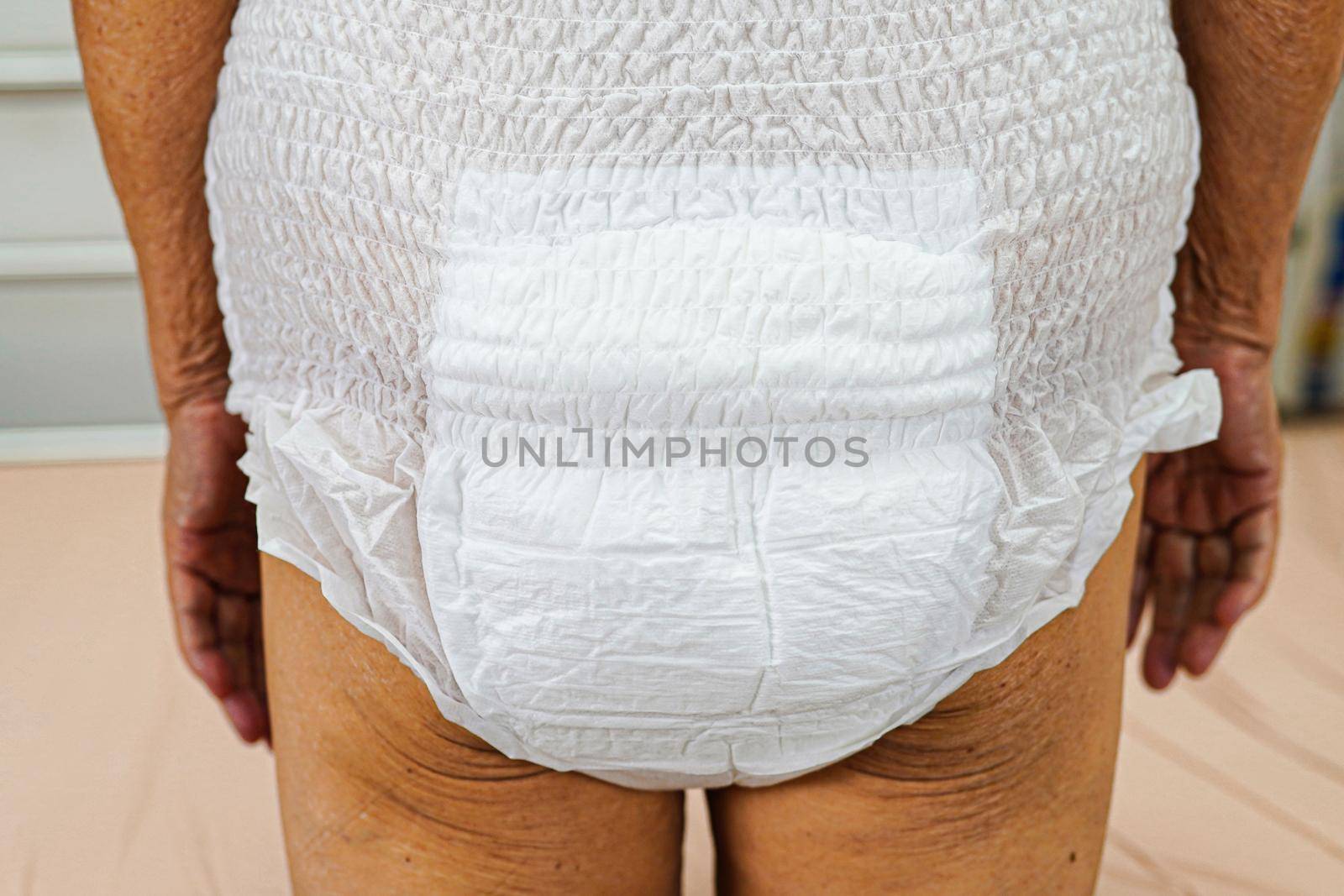 Asian elder senior woman patient wearing adult incontinence diaper pad in hospital.