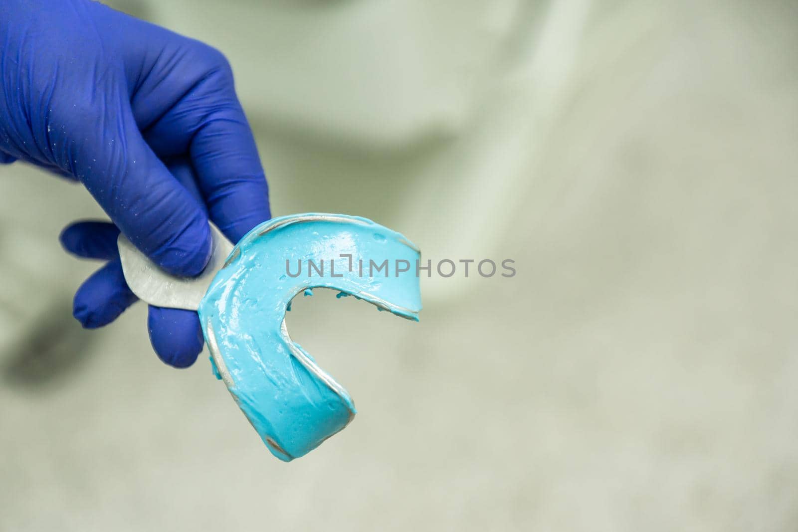 blue alginate filled mold for dental impression by jatmikaV