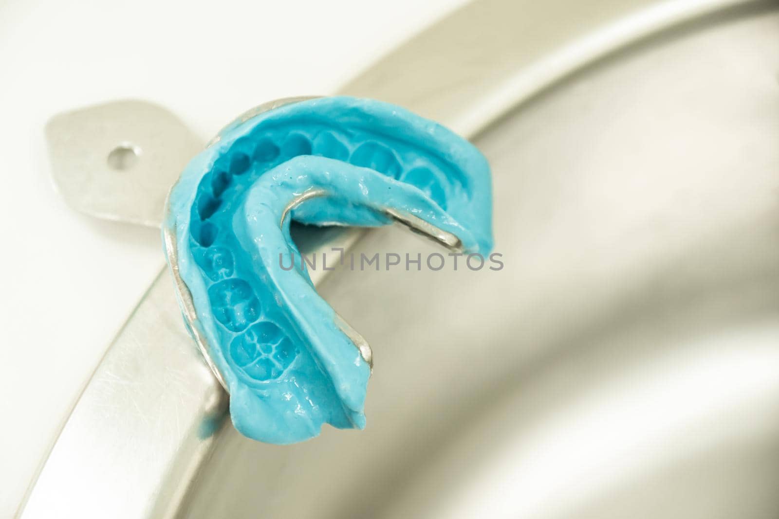 metal blue alginate dental impression mold