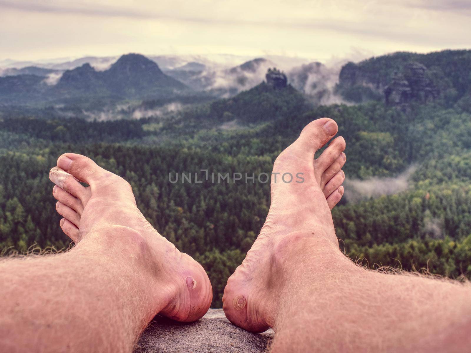 Big bloody callus on man's heel. Closeup of man feet relax  by rdonar2
