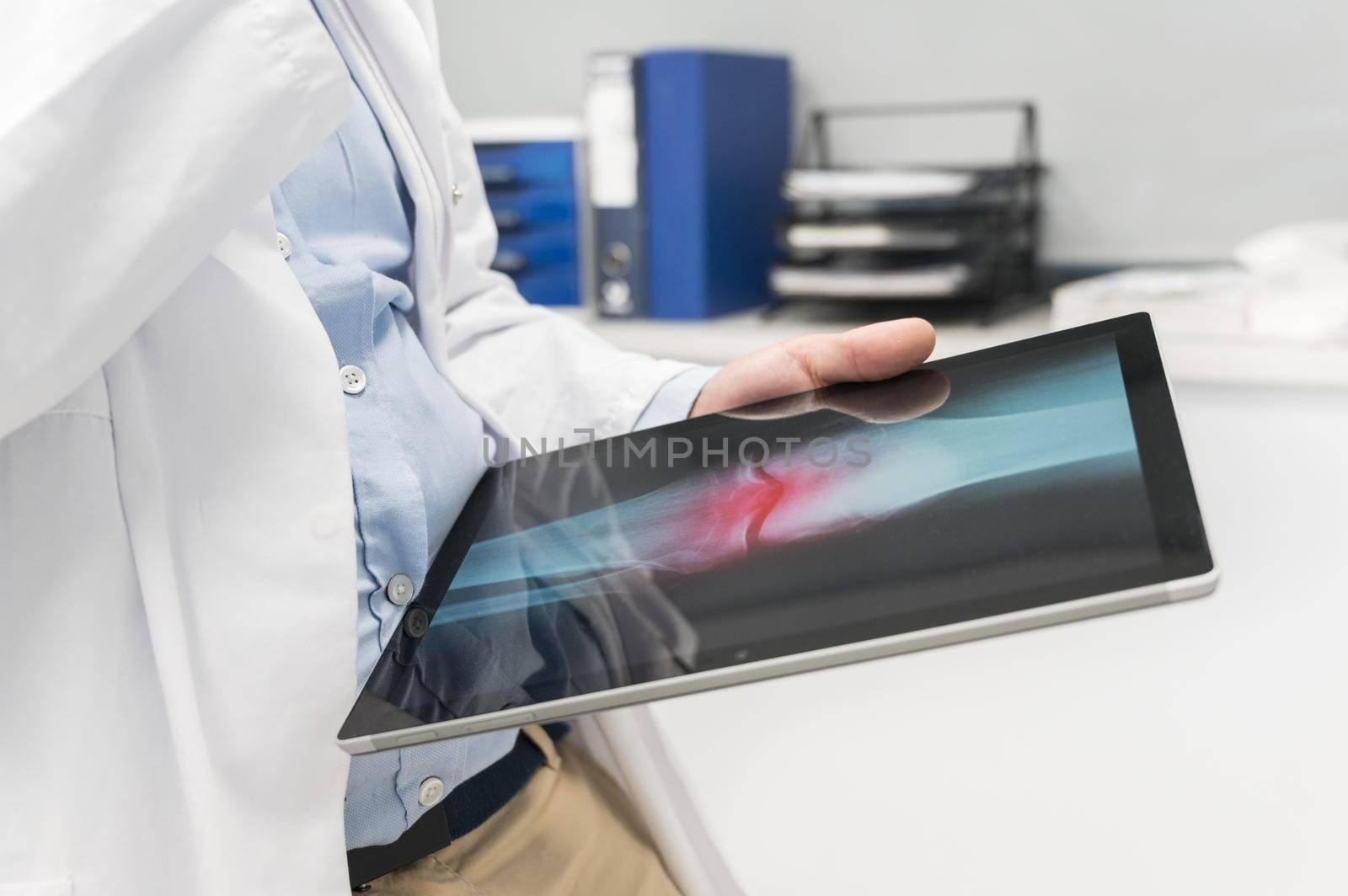 Unrecognizable Doctor is checking x-ray image at computer tablet, close up. Doctor at work in a hospital. Medicine and healthcare concept. by HERRAEZ