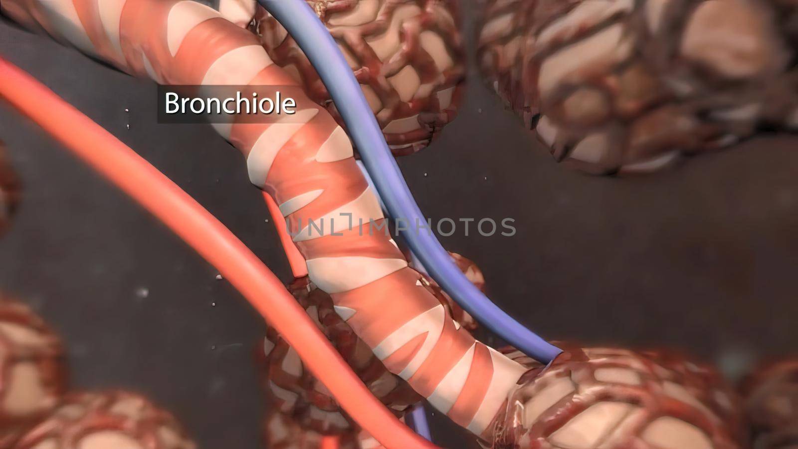 The bronchi are extensions of the windpipe that carries air to the lungs by creativepic