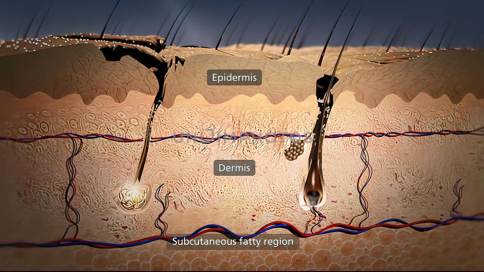 Inflammation and swelling of the skin 3D illustration,