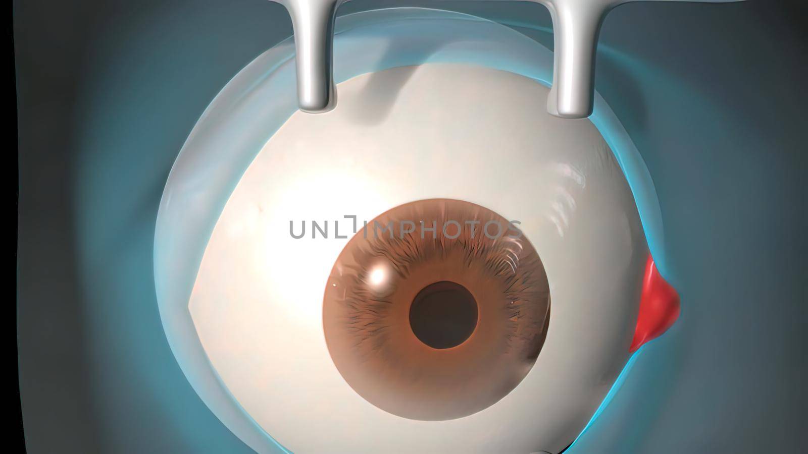 Cataract surgery application view Surgical operations on the human eye by creativepic