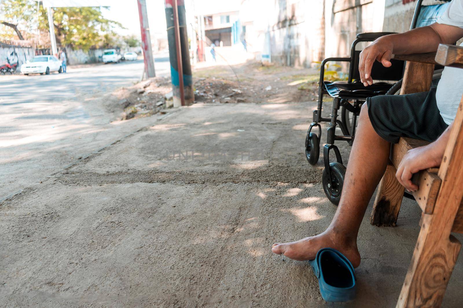 Closeup of a disabled Latino man, without a leg due to diabetes sitting outside his house in a chair with his wheelchair by cfalvarez