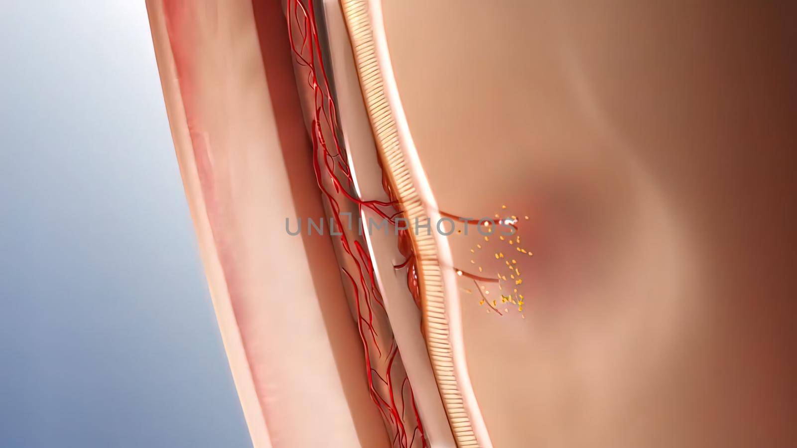 Glaucoma eye disease 3D illustration medical by creativepic