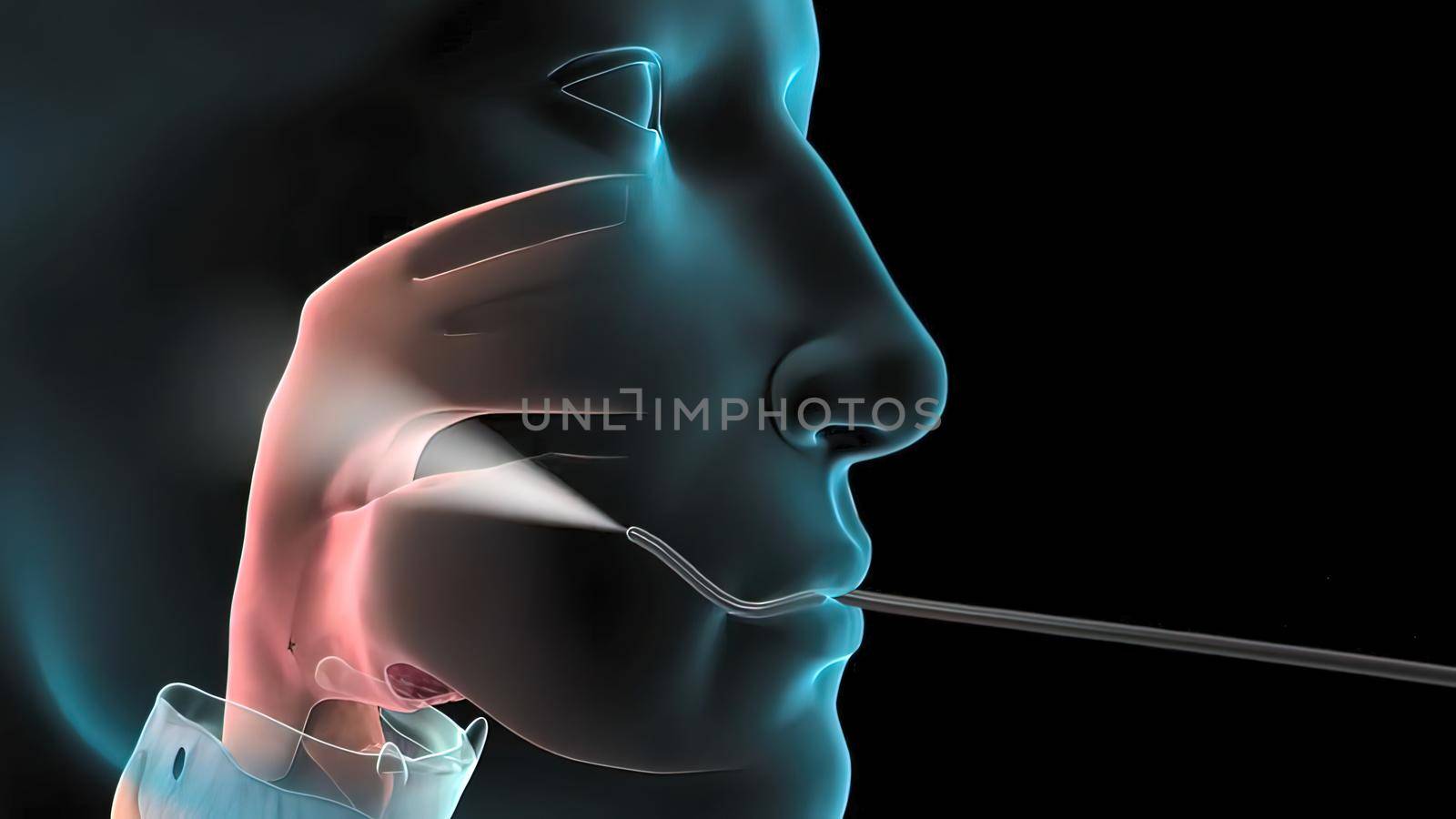 Medical doctor confirming condition of lungs using bronchoscope and fluorescent image 3D illustration