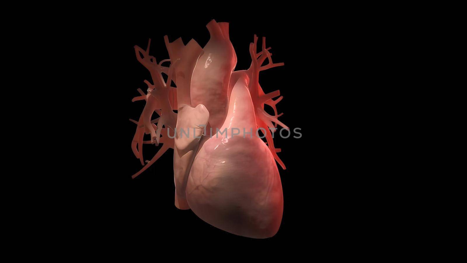 medically accurate illustration of a heart with 3 bypasses by creativepic