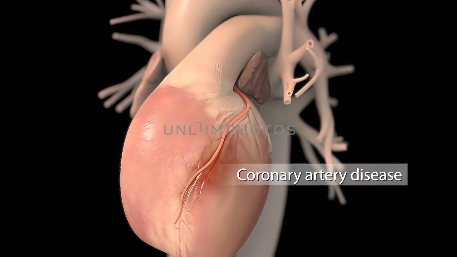 Human heart, realistic anatomy 3d model of human heart on the monitor, visual heart beating. Human anatomy, cardiovascular system. 3D illustration