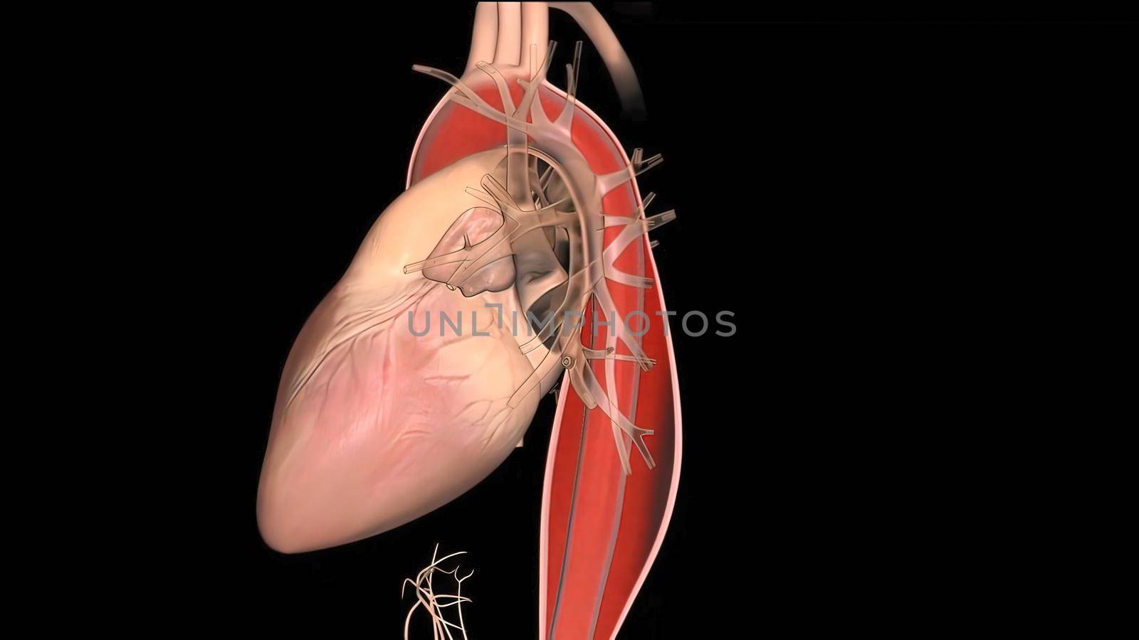 It may affect the left ventricle, aorta, aortic valve, or mitral valve. by creativepic