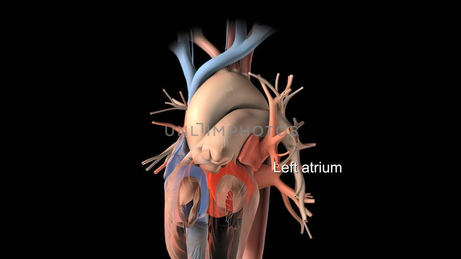 Disruption and enlargement of the heart rhythm 3D Render