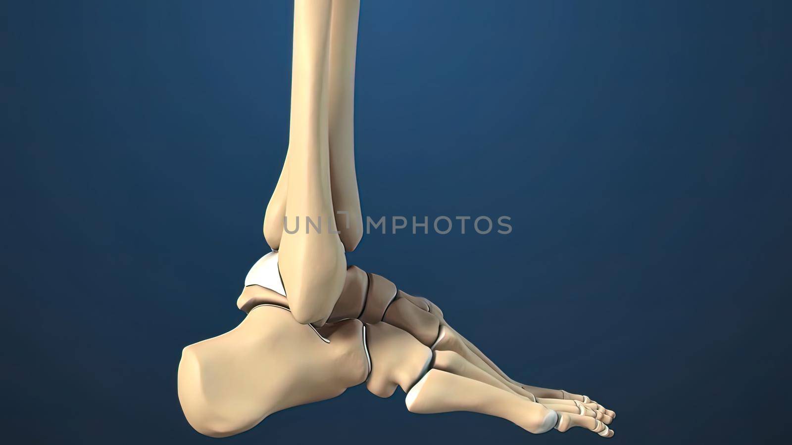 Foot and Ankle Fracture 3d medical illustration