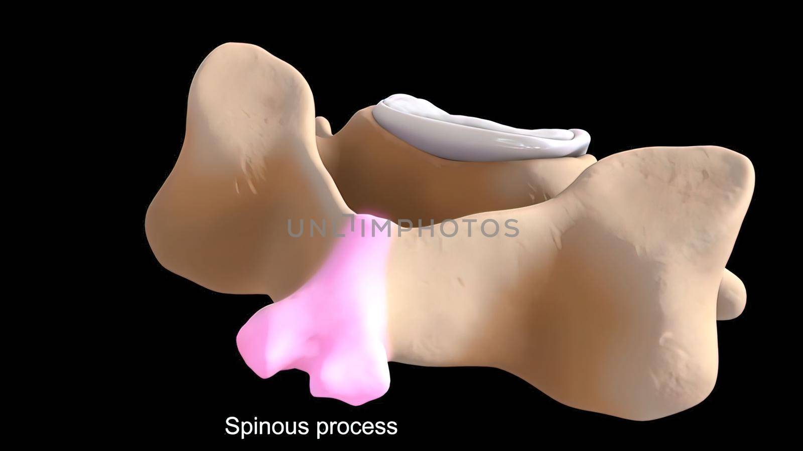 3D Render of Ankle Joint Anatomy and Osteoarthritis.The ankle is where the long tibia and fibula bones of the shin meet with the foot s talus bone.