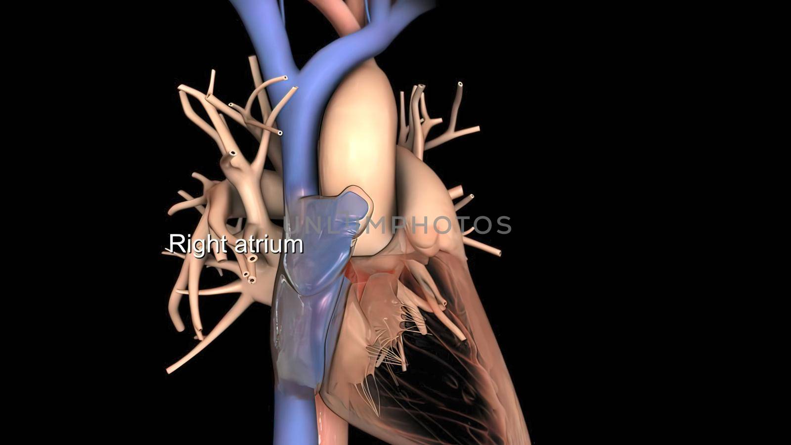 Disruption and enlargement of the heart rhythm 3D Render