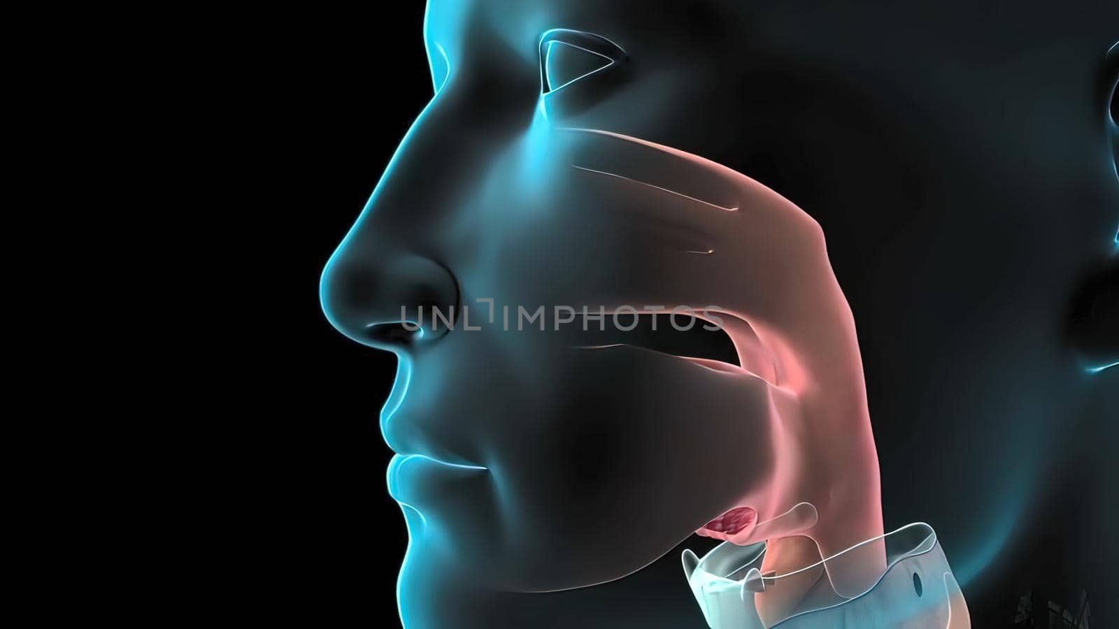 Damaged sick lungs. 3D render illustration for respiratory problems, cancer medical or health problems. Disease, respiratory problems, tumor and clinical case in the human body