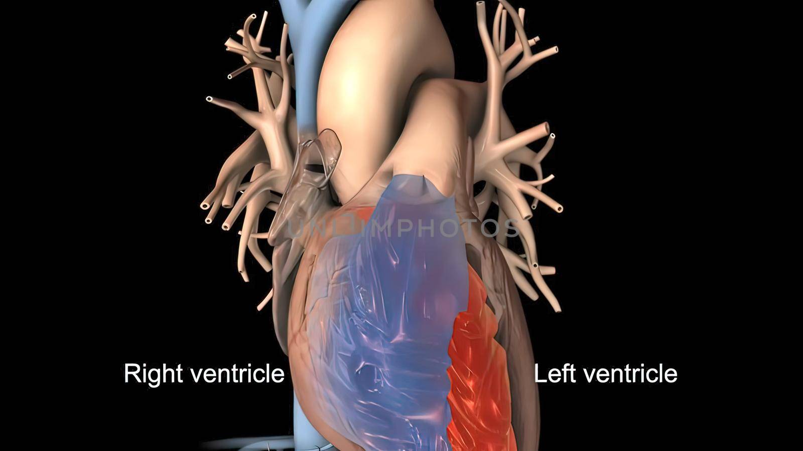 Disruption and enlargement of the heart rhythm 3D Render