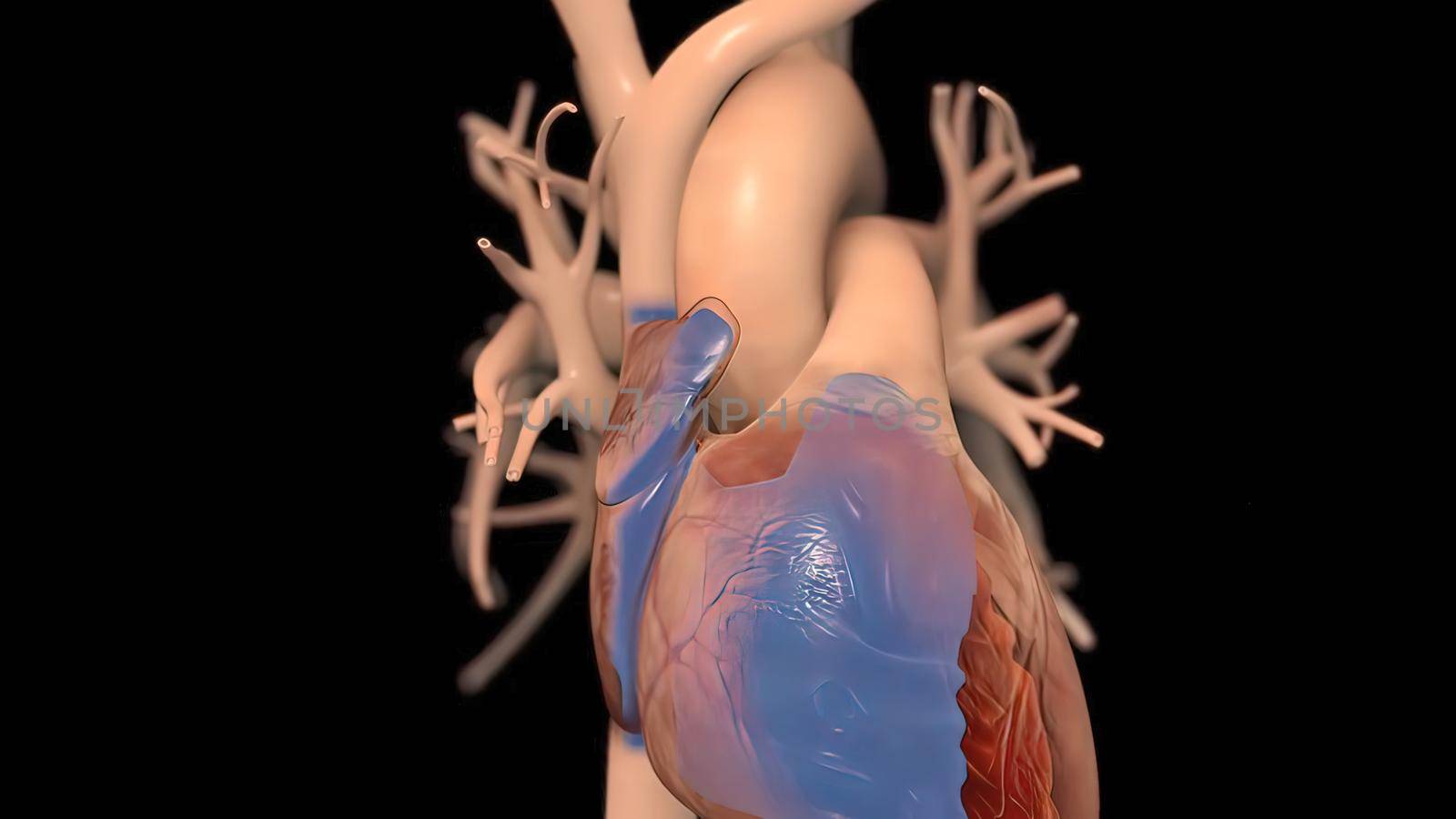 It means respiratory failure due to heart failure, edema, growth in the liver and obvious disease. 3D illustration