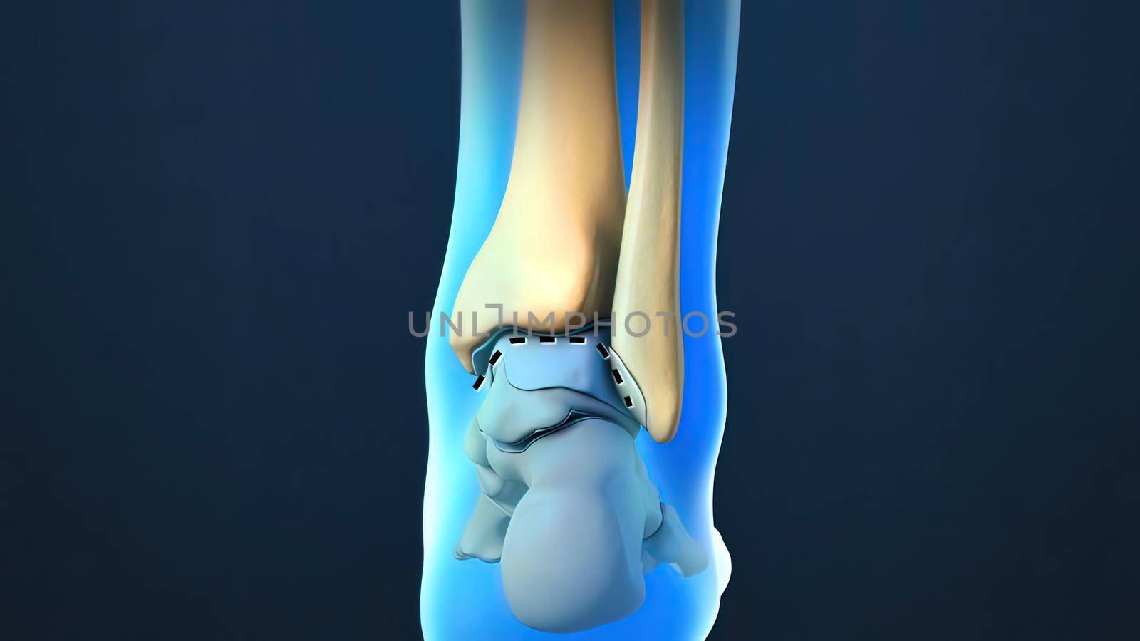 Ankle Joint Anatomy and articular cartilage 3d Render by creativepic