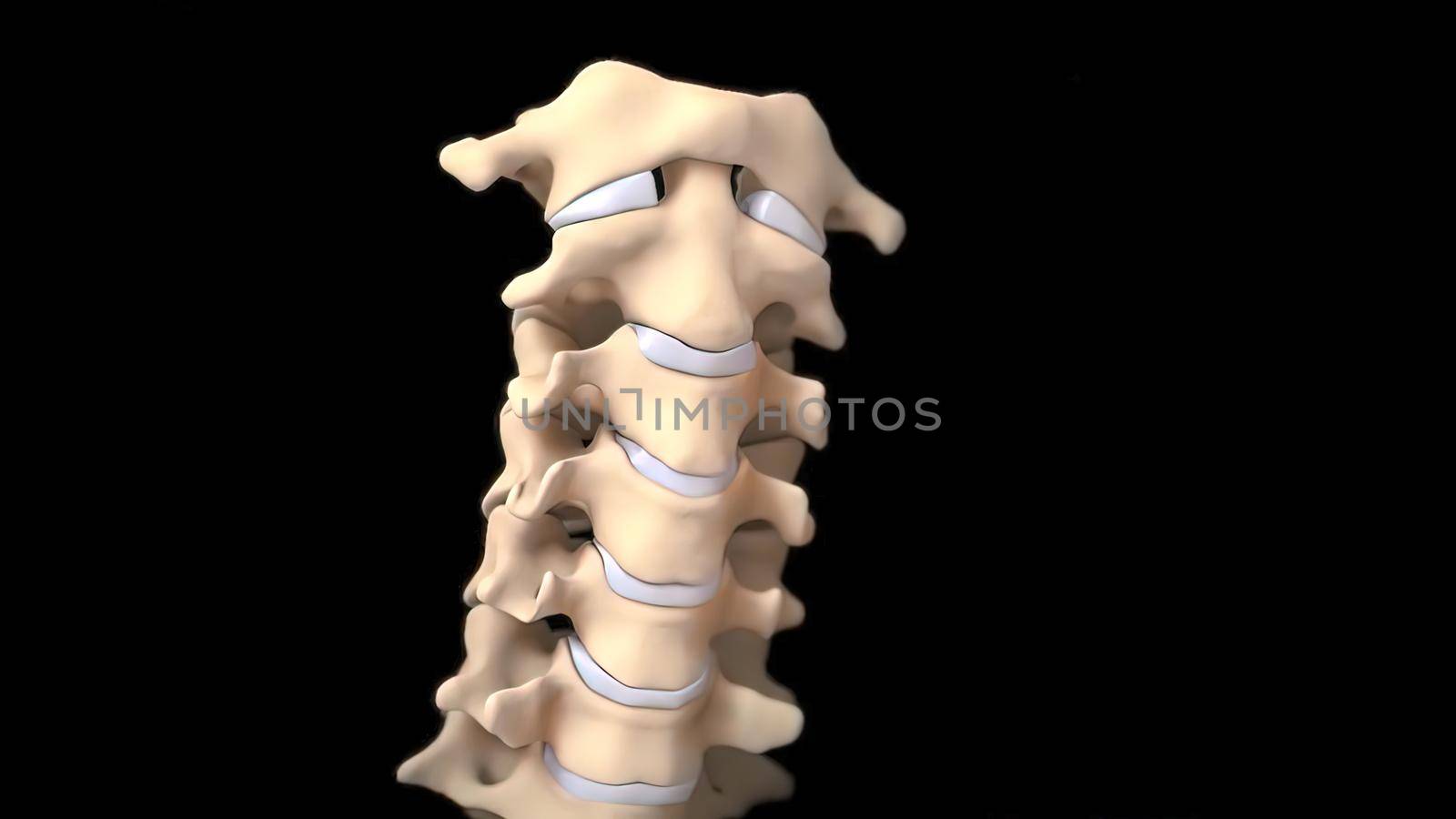 3D medical 3D illustration of cervical spine on by creativepic