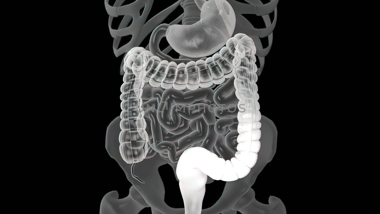 In this way, polyps, cancerous cells and abnormal structures in the large intestine can be diagnosed. The aim is to treat colon cancer, ulcerative colitis,3D illustration