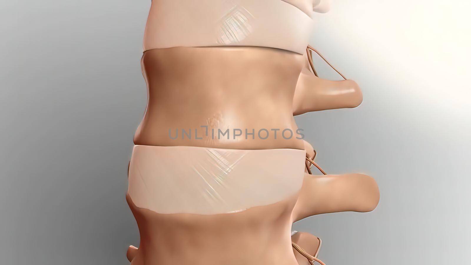 Cervical spine .Chronic Low Back Pain. 3D illustration
